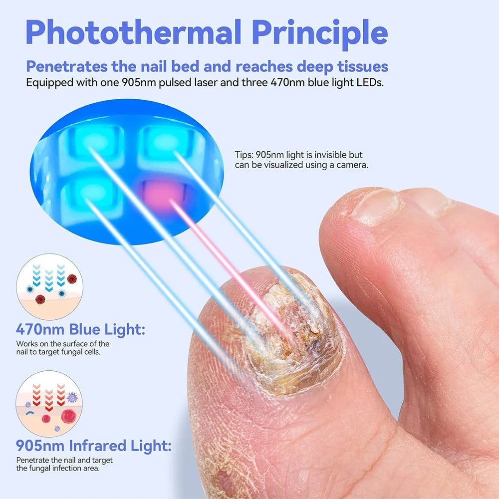 Portable Grey Nail Assist Tool UV Professional Nail Fungus Cleaning Laser Device Nail Phototherapy Lamp Type-C Charging Wholesal