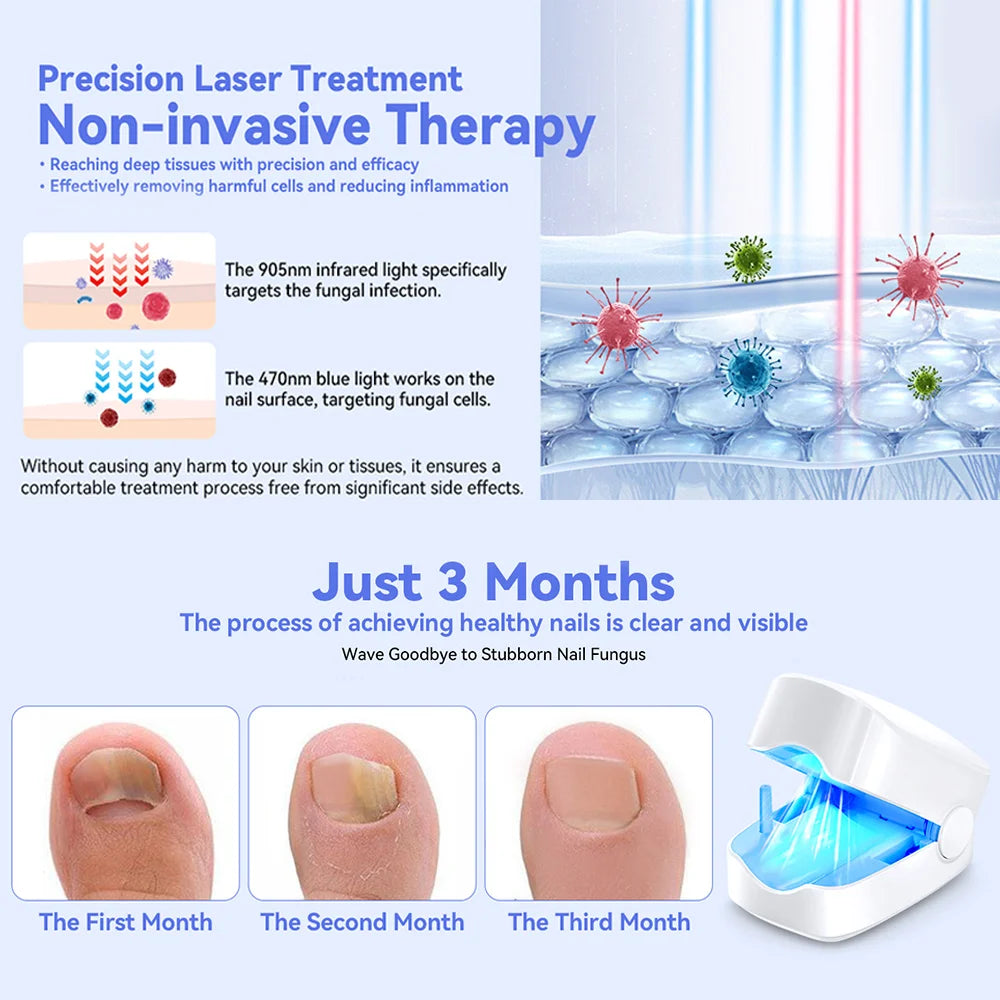 Portable Grey Nail Assist Tool UV Professional Nail Fungus Cleaning Laser Device Nail Phototherapy Lamp Type-C Charging Wholesal